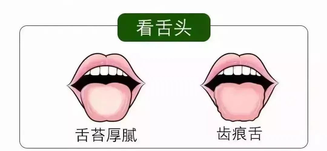 清明時節(jié)雨紛紛 疏通經(jīng)絡(luò)馬上給身體加分！